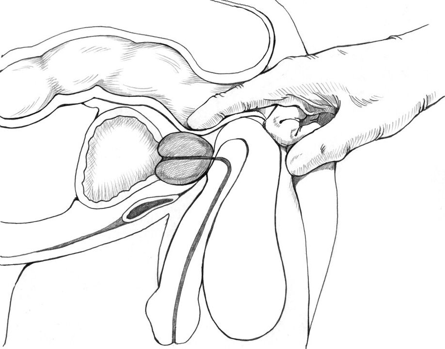 Masaż prostaty wchodzi w skład kompleksu metod leczenia zapalenia gruczołu krokowego